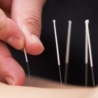 A-Care Acupuncture & Health Center image 3